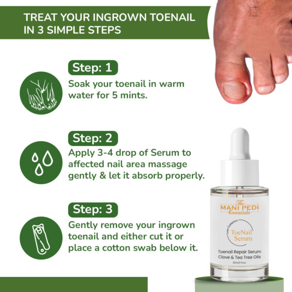 Ingrown Toenail Serum. Softens Ingrown nails, helps relieve pain and helps prevent infection. Natural Ingredients - 30ml - Image 3