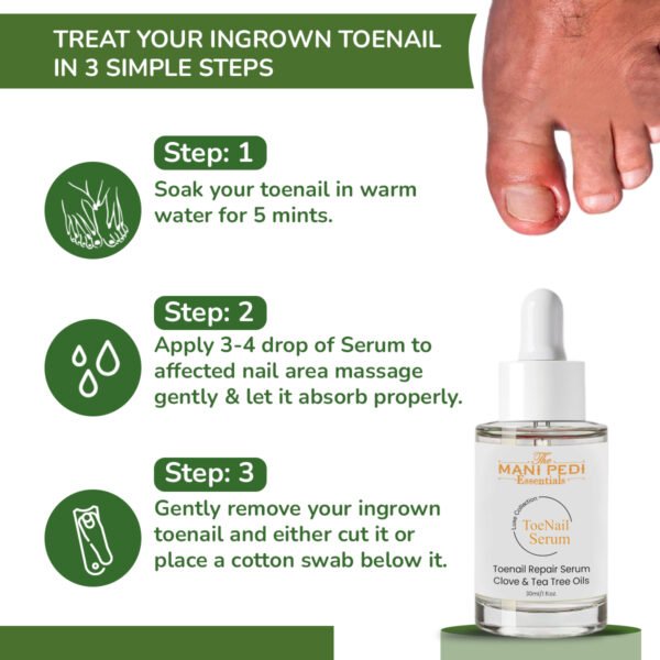 Ingrown Toenail Serum. Softens Ingrown nails , helps relieve pain - Image 2